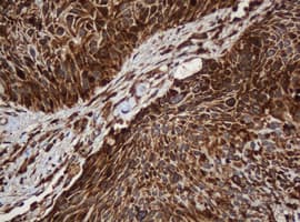 PAI-RBP1 / SERBP1 Antibody (clone OTI5G2)