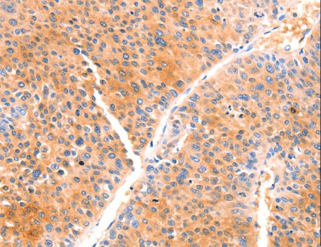 PRDX2 / Peroxiredoxin 2 Antibody