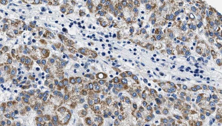 ADCY5 / Adenylate Cyclase 5 Antibody