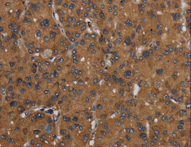 Polyclonal Rabbit anti-Human ID2 Antibody (IHC)