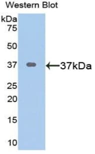 CTGF Antibody (aa25-348, Biotin)