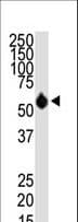 HDAC8 Antibody (aa1-30)