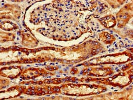 Polyclonal Rabbit anti-Human FZD1 / Frizzled 1 Antibody (IHC, IF)