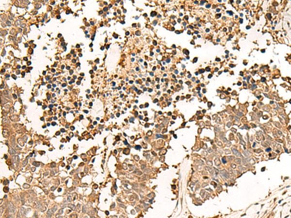 LDHA / LDH1 Antibody