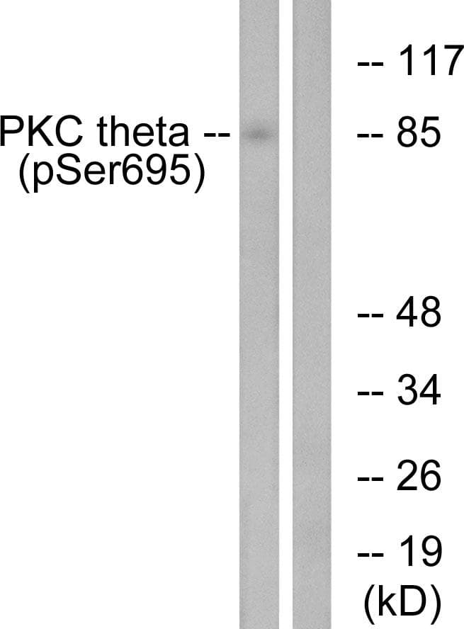 PRKCQ / PKC-Theta Antibody (phospho-Ser695)