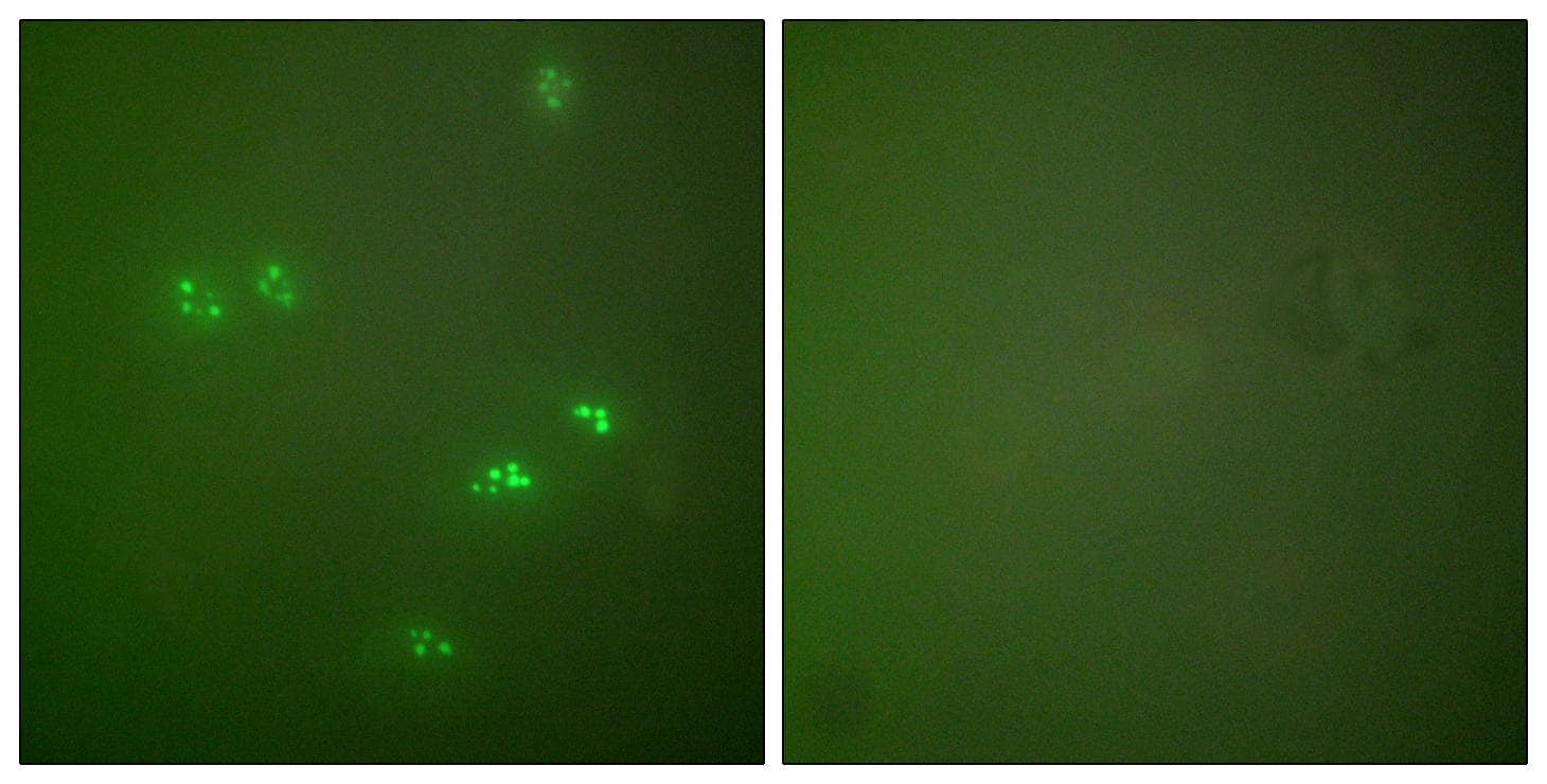 Polyclonal Rabbit anti-Human p14ARF / CDKN2A Antibody (IHC, IF, WB)