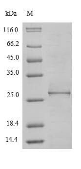 Borrelia burgdorferi clpP2 Protein (Recombinant 10His, N-terminus + Myc, C-terminus)