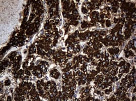 HSPD1 / HSP60 Antibody (clone OTI6F7)