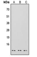 S100A7 / Psoriasin Antibody (Internal)