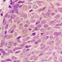 Polyclonal Rabbit anti-Human RPL12 / Ribosomal Protein L12 Antibody (Internal, IHC, WB)