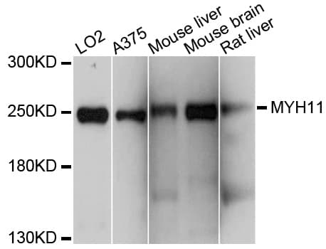 IHC-plus™ SMMHC / MYH11 Antibody