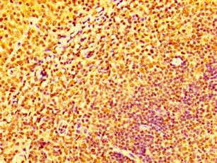 IFNGR2 Antibody