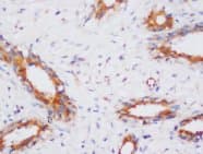 PP2Ac / PPP2CA Antibody (N-Terminus)