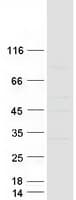 Human KRT18P55 Protein (Recombinant Myc-DDK (Flag))