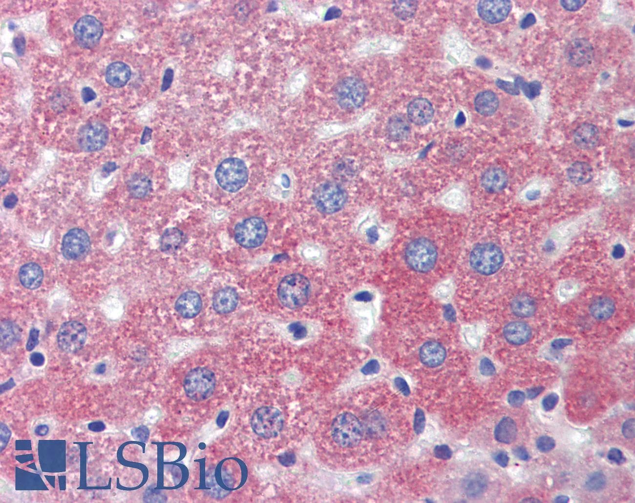 Polyclonal Rabbit anti-Human LAMP1 / CD107a Antibody (IHC, IF, WB)