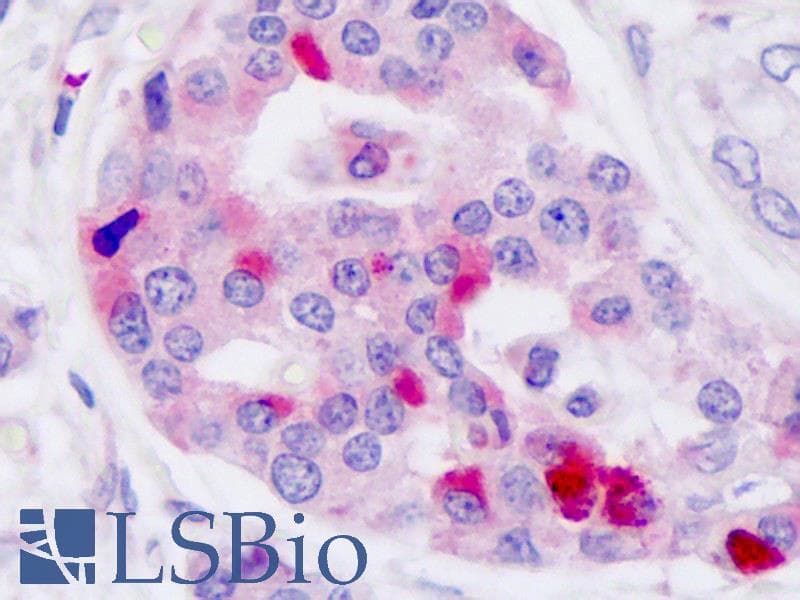 PathPlus™ Polyclonal Rabbit anti-Human GLP1R / GLP-1 Receptor Antibody (N-Terminus, IHC, IF, WB)