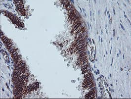 CAST / Calpastatin Antibody (clone OTI1E7)