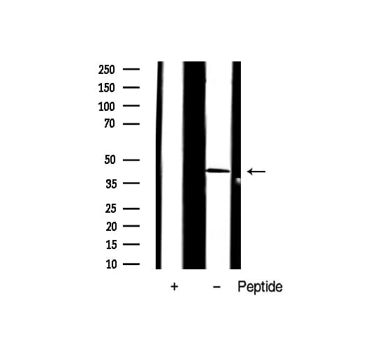 Polyclonal Rabbit anti-Human AP-1 / JUND Antibody (IHC, IF, WB)