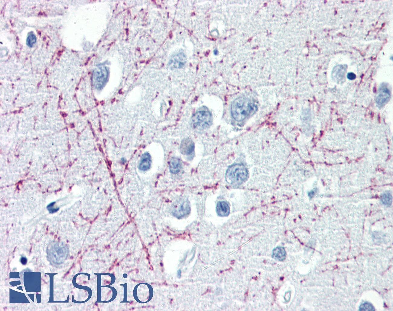IHC-plus™ PLP1 / Myelin PLP Antibody (C-Terminus, clone plpc1)