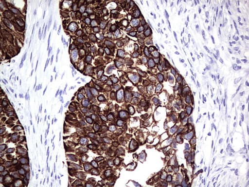 Monoclonal Mouse anti-Human KRT19 / CK19 / Cytokeratin 19 Antibody (clone OTI5F4, aa240-390, IHC, WB)