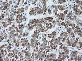 HMRF1L / MTRF1L Antibody (clone OTI1C8)