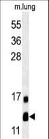 Polyclonal Rabbit anti-Human LYRM2 Antibody (aa19-47, WB)