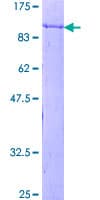 Human SNX1 Protein (Recombinant GST)