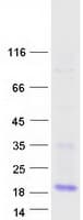 Human FAM24B Protein (Recombinant Myc-DDK (Flag))