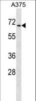 CDYL Antibody (aa6-34)