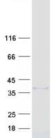 Human ZCCHC9 Protein (Recombinant Myc-DDK (Flag))