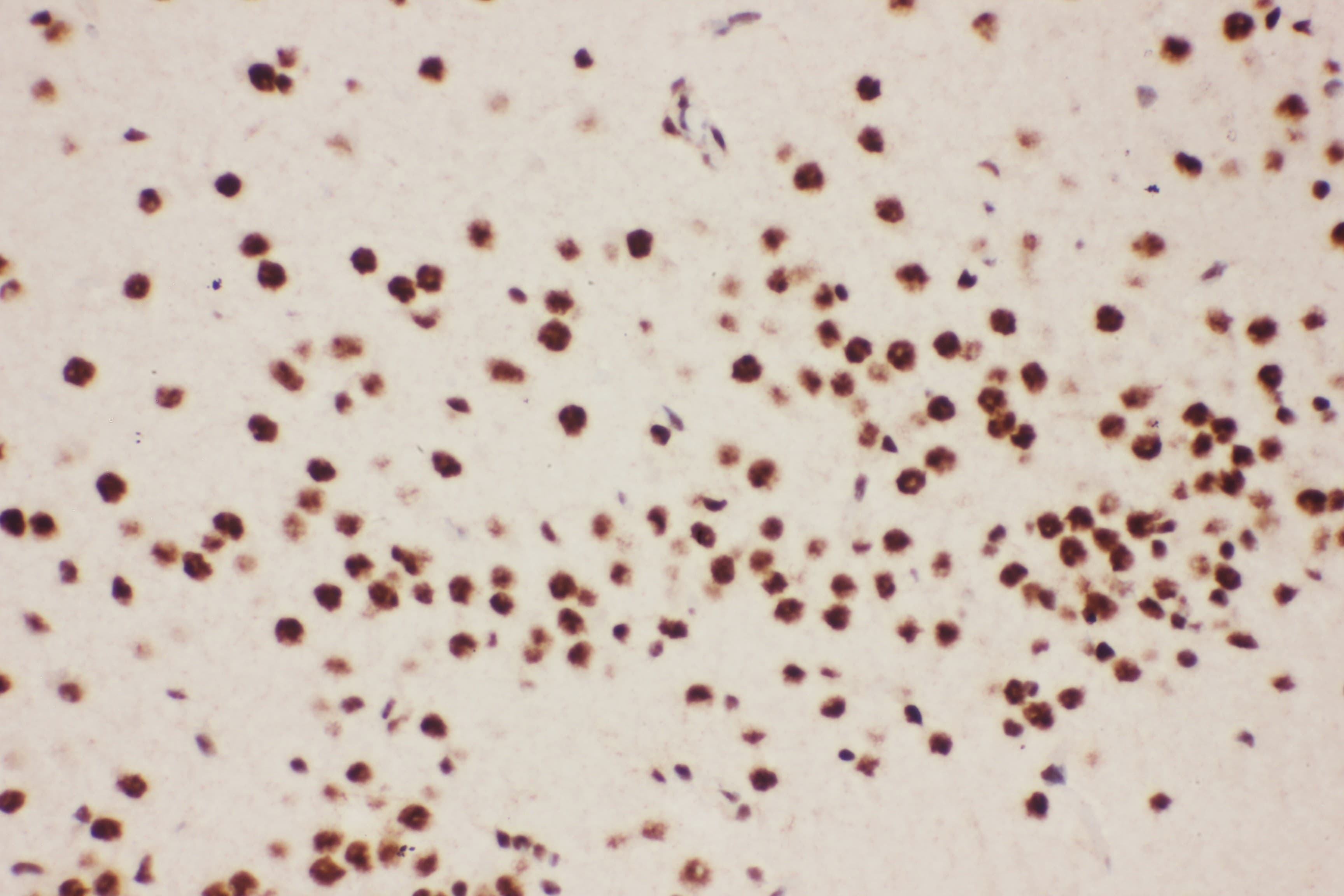 ALOX5 / 5-LOX Antibody (aa120-483)