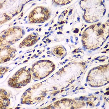 RPN1 / Ribophorin I Antibody