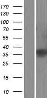 ETV2 Protein (Over-Expression Lysate Myc-DDK (Flag))