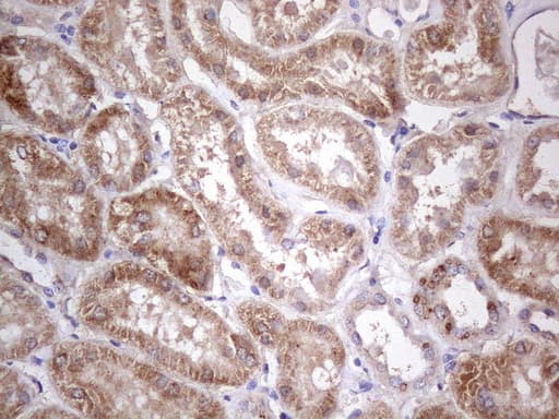 ABAT Antibody (aa29-323, clone UMAB179, Carrier-free)