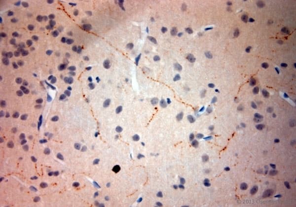 Polyclonal Rabbit anti-Rat SYNPO / Synaptopodin Antibody (aa890-930, IHC)