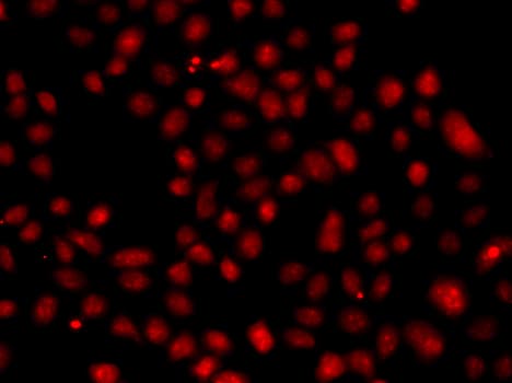 Polyclonal Rabbit anti-Human FBXW11 Antibody (IHC, IF, WB)