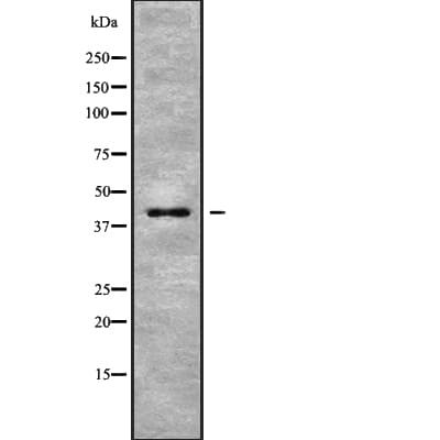 Polyclonal Rabbit anti-Human PTGER1 / EP1 Antibody (IHC, IF, WB)