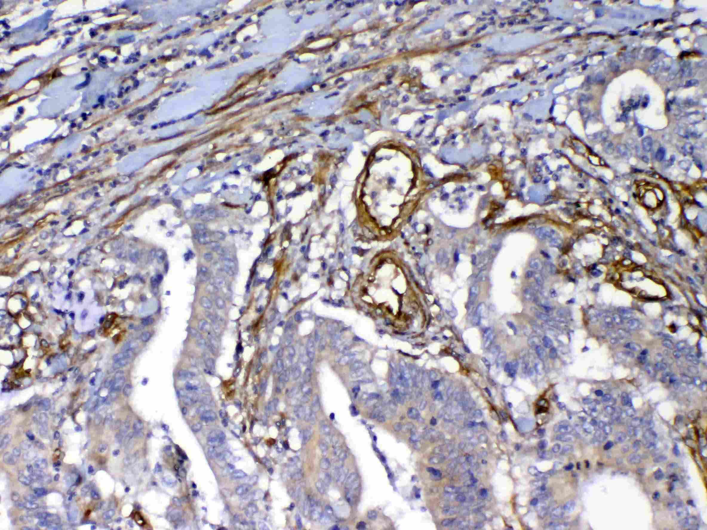 FLT4 / VEGFR3 Antibody