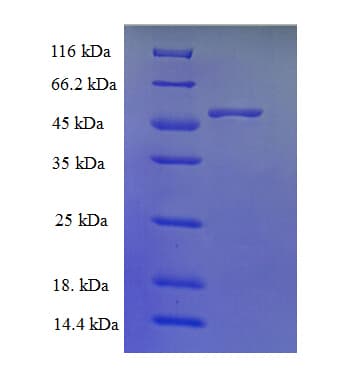 Human TMLHE / TMID Protein (Recombinant His)