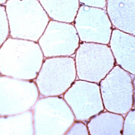 DMD / Dystrophin Antibody (C-Terminus)