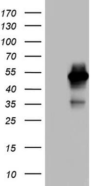 Monoclonal Mouse anti-Human MAPKAPK5 / PRAK Antibody (clone OTI1D11, aa197-471, WB)