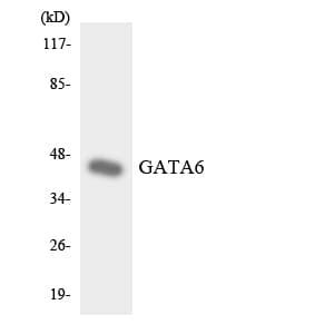GATA6 Antibody (aa444-493)