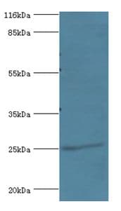 DGCR6L Antibody (aa1-220, FITC)
