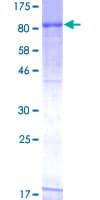 Human RIOK3 Protein (Recombinant GST)