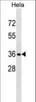 RNF34 Antibody (aa283-311)