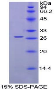 Chicken KIAA0152 / MLEC Protein (Recombinant His)
