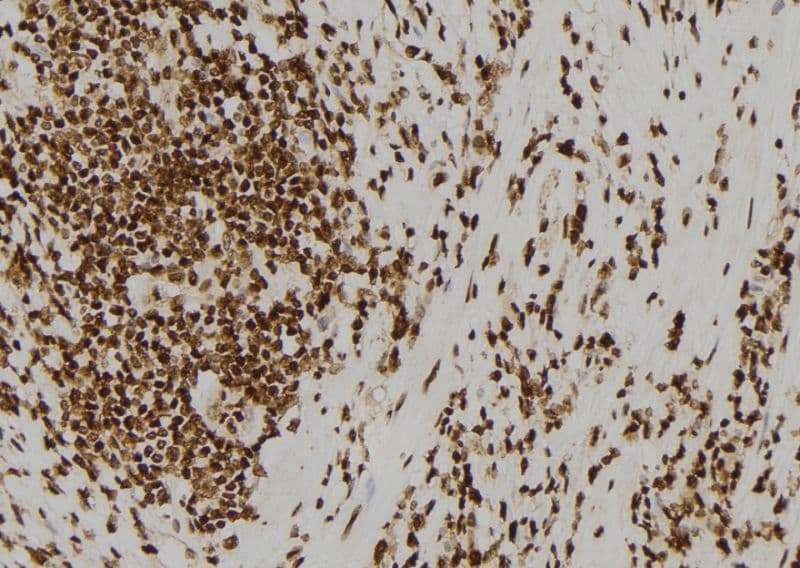 Polyclonal Rabbit anti-Human ASCL1 / MASH1 Antibody (IHC, WB)