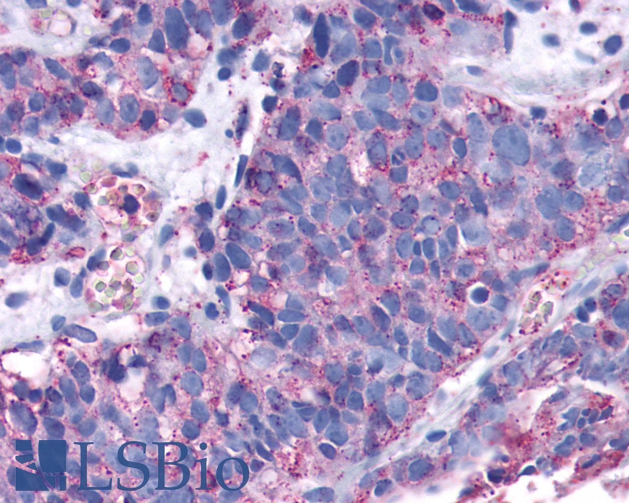 PathPlus™ SIPR3 / EDG3 / S1P3 Antibody (N-Terminus)