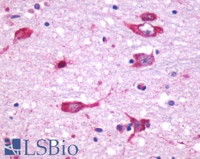 PathPlus™ Polyclonal Rabbit anti-Human CHRM5 / M5 Antibody (Cytoplasmic Domain, IHC)