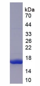 Human MASP2 / MASP-2 Protein (Recombinant His)